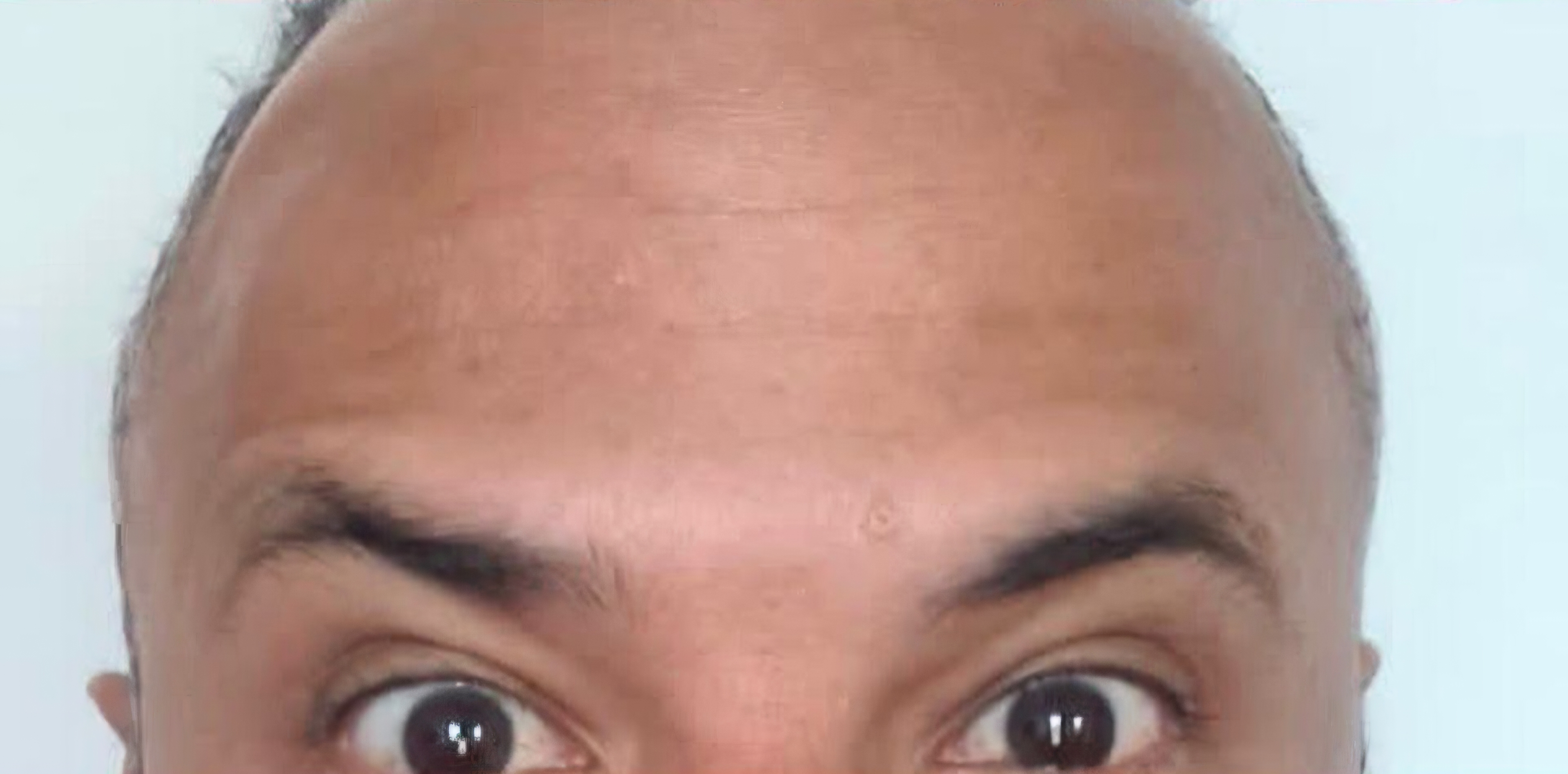 Antes